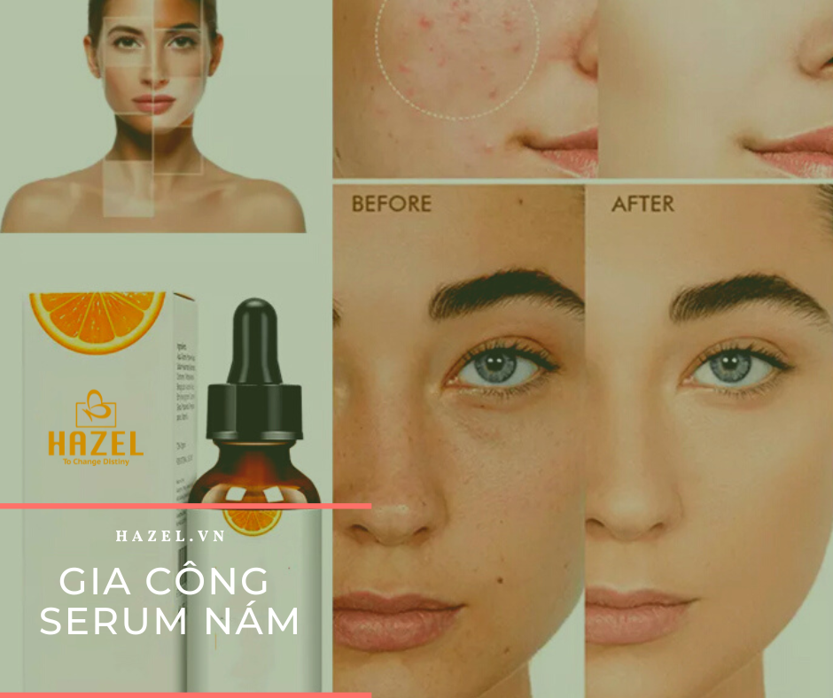 Sản phẩm gia công serum nám điểm NỔI BẬT mà nàng không thể ngó lơ HAZEL Sản phẩm gia công serum nám điểm NỔI BẬT mà nàng không thể ngó lơ HAZEL