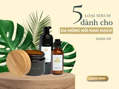 [GÓC REVIEW] 5 loại Serum “GIẢI CỨU” cho những làn DA MỎNG NỔI MẠCH MÁU: Gia công mỹ phẩm HAZEL