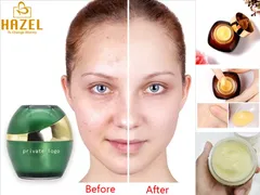 Gia công kem dưỡng retinol- dưỡng chất “vàng” giảm nhăn và trị mụn
