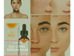 Sản phẩm gia công serum nám và điểm NỔI BẬT mà các cô nàng cần biết