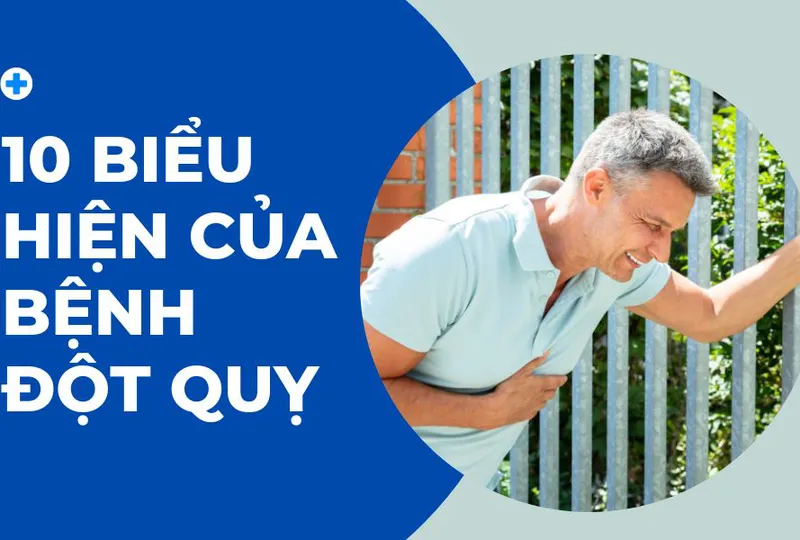 10 biểu hiện của đột quỵ