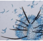 THUỐC ĐẶC TRỊ THÁN THƯ TRÊN SẦU RIÊNG