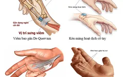 VẤN ĐỀ THƯỜNG GẶP Ở KHỚP CỔ TAY