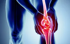 PHÒNG TRÁNH THOÁI HÓA KHỚP GỐI