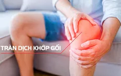 CẦN LÀM GÌ KHI BỊ TRÀN DỊCH KHỚP GỐI