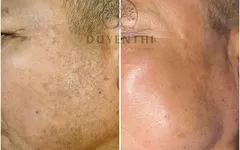 Tại Sao Nên Chọn Nhung Beauty Spa - Điểm Đến Chăm Sóc Da