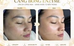 ENZYME CĂNG BÓNG & PHỤC HỒI