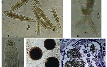 Cách xổ ký sinh trùng Gregarine an toàn và hiệu quả