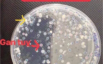 CÁCH KIỂM TRA MẬT SỐ VIBRIO TRONG NƯỚC VÀ TÔM