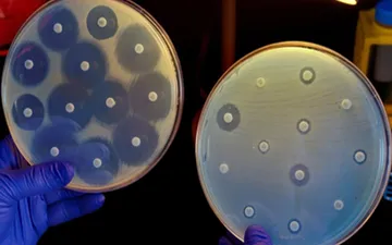 CÁCH LÀM KHÁNG SINH ĐỒ TẠI AO