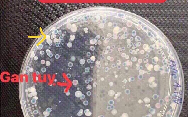 CÁCH KIỂM TRA MẬT SỐ VIBRIO TRONG NƯỚC VÀ TÔM
