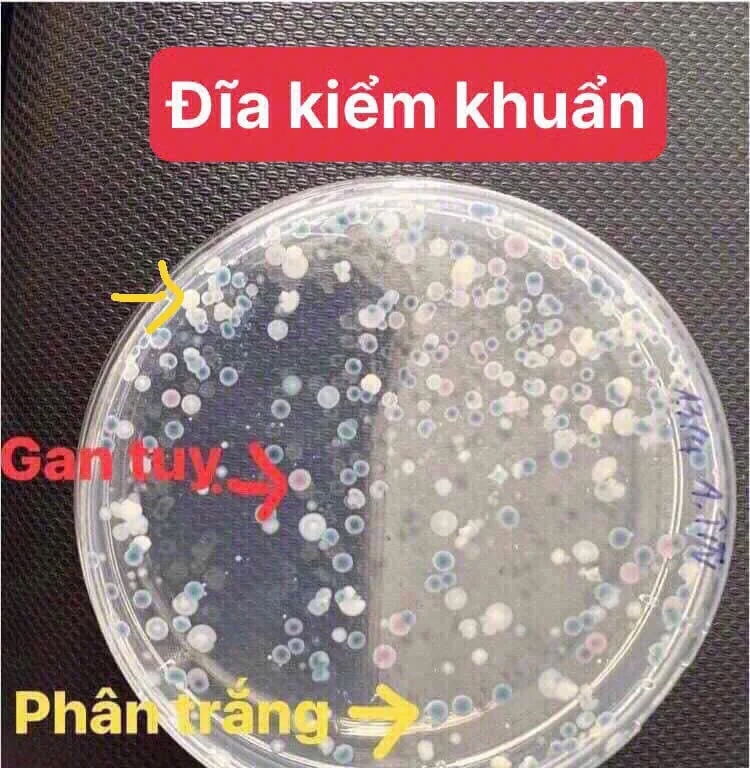 Kiểm tra mật số Vibrio