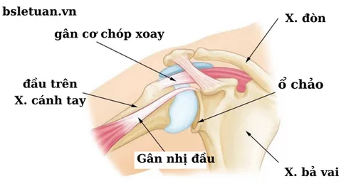 RÁCH GÂN CƠ CHÓP XOAY