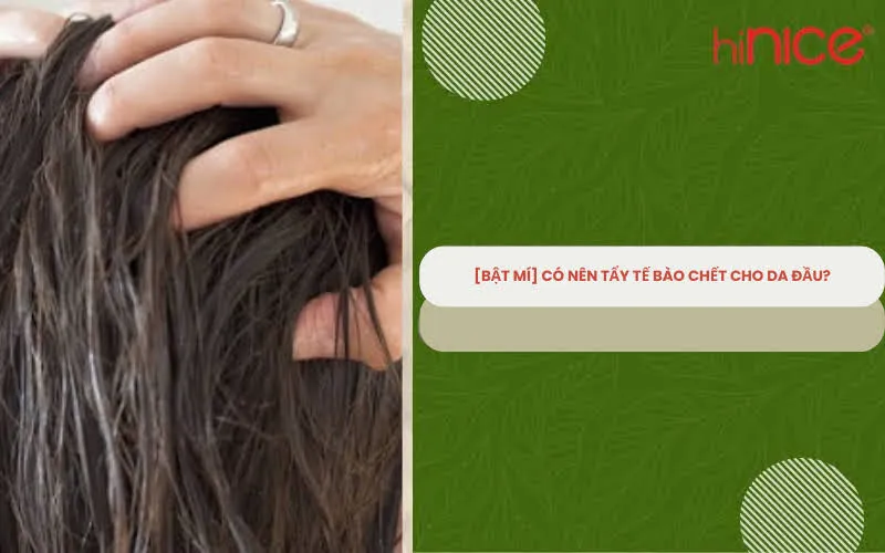 [Bật mí] Có nên tẩy tế bào chết cho da đầu?