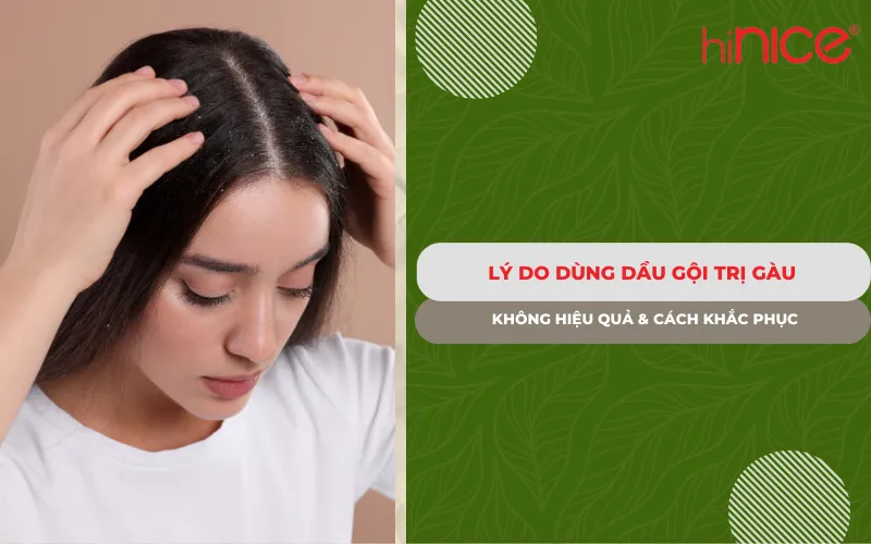 Lý do dùng dầu gội trị gàu nhưng vẫn không hiệu quả & cách khắc phục