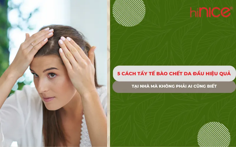 5 Cách tẩy tế bào chết da đầu hiệu quả tại nhà mà không phải ai cũng biết