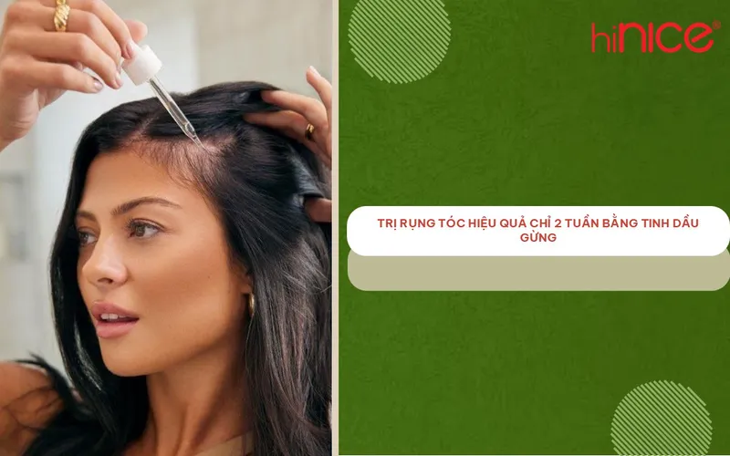 Trị rụng tóc hiệu quả chỉ 2 tuần bằng tinh dầu gừng