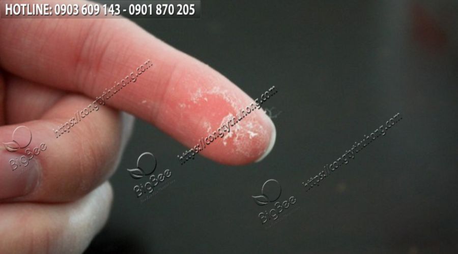 Xử lý gọn gàng vết keo dính trên tay Xử lý gọn gàng vết keo dính trên tay