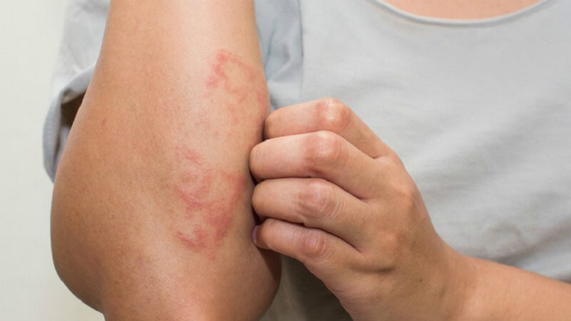 Các dấu hiệu khi cần thải độc cho gan Các dấu hiệu khi cần thải độc cho gan