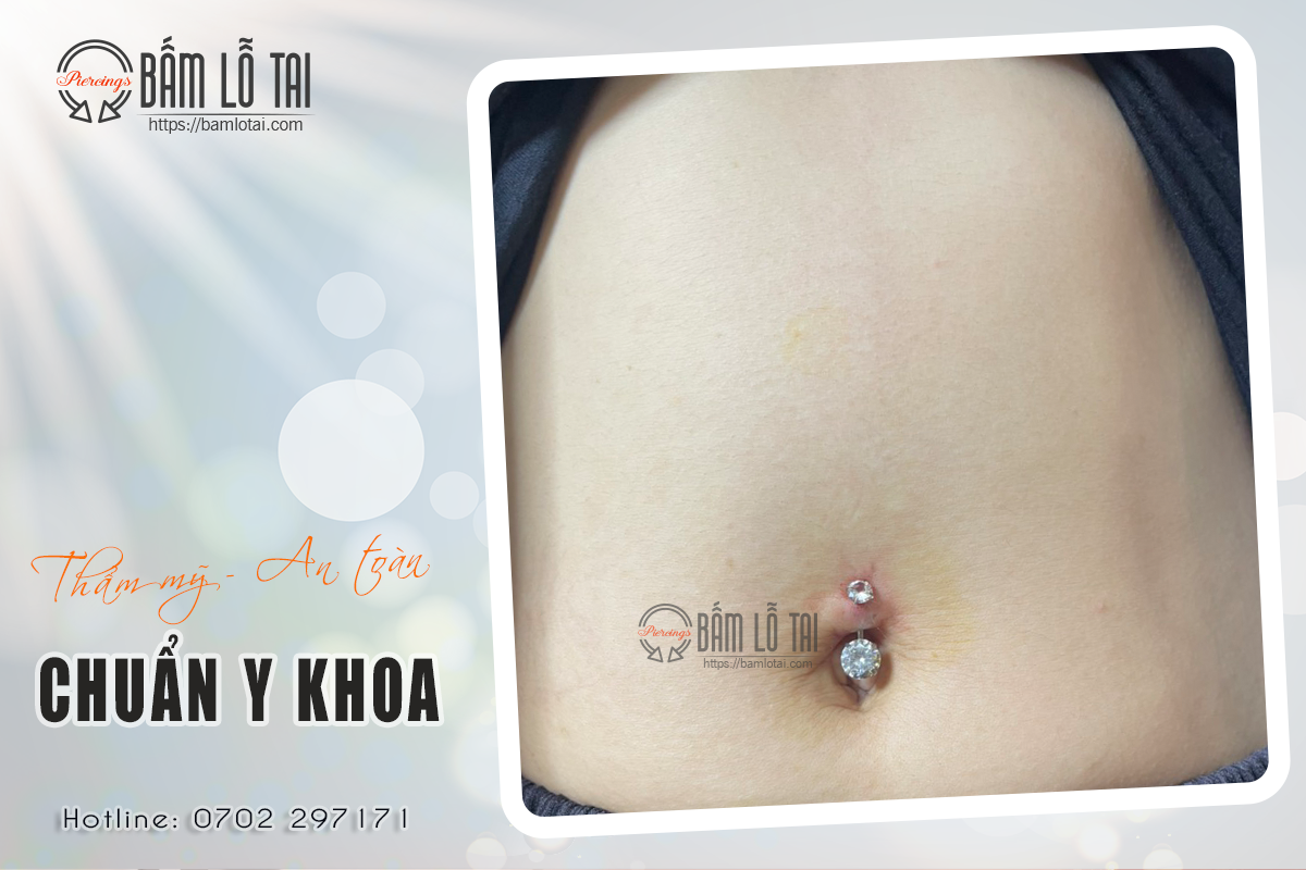 Xỏ khuyên rốn chuẩn y khoa