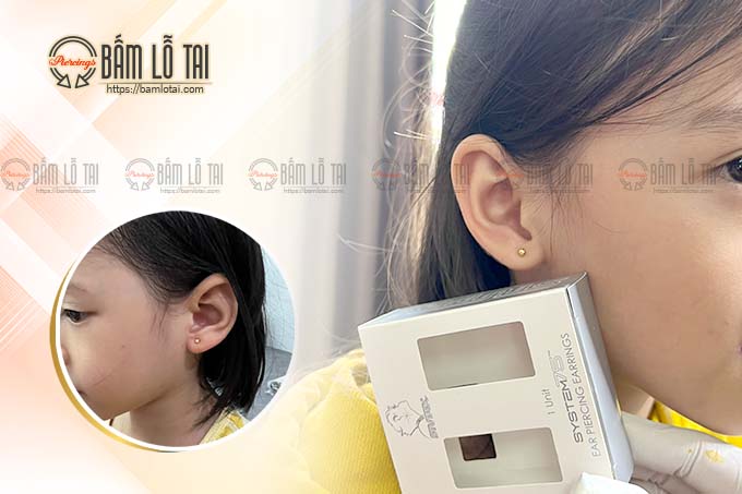 bấm lỗ tai trẻ em