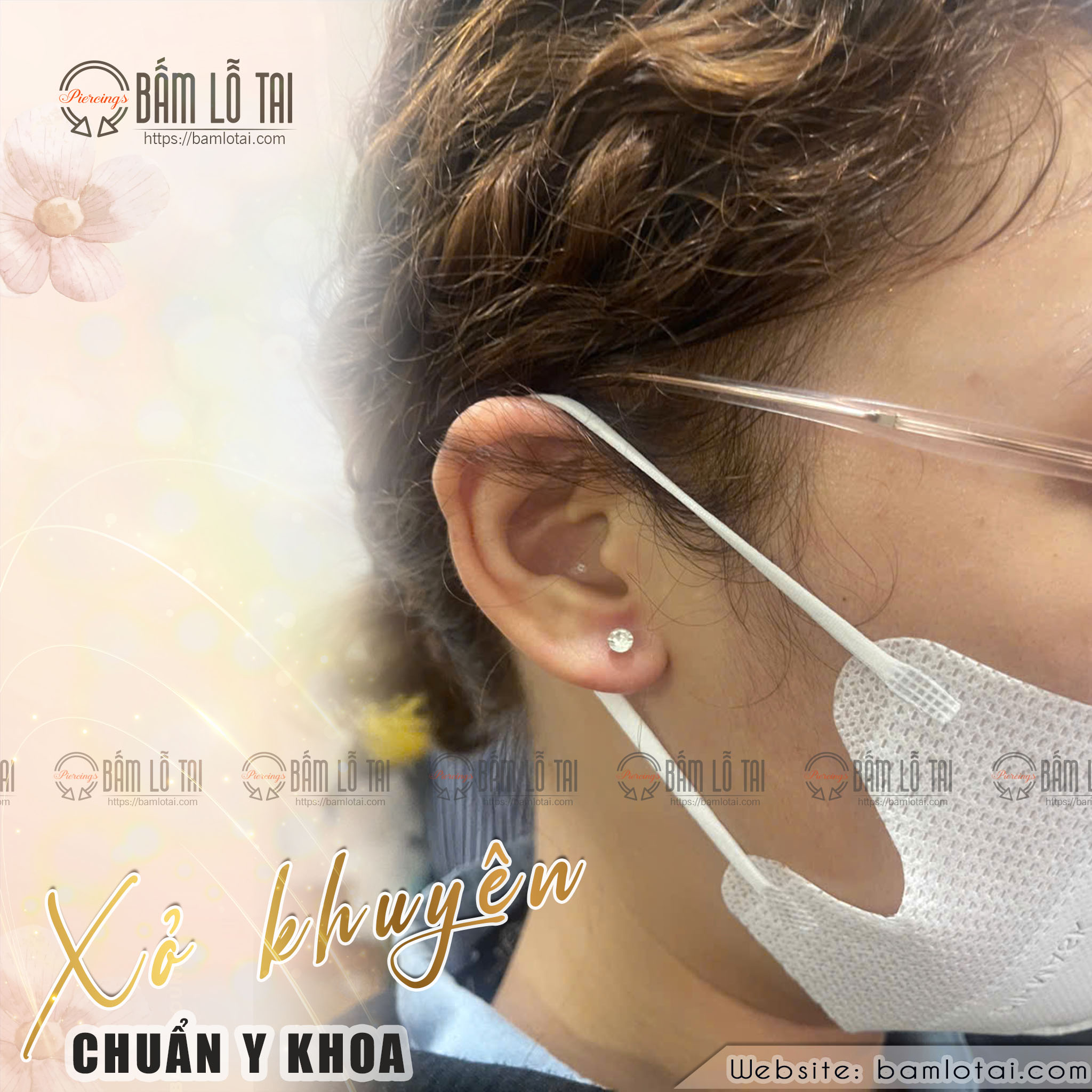 xỏ khuyên y khoa