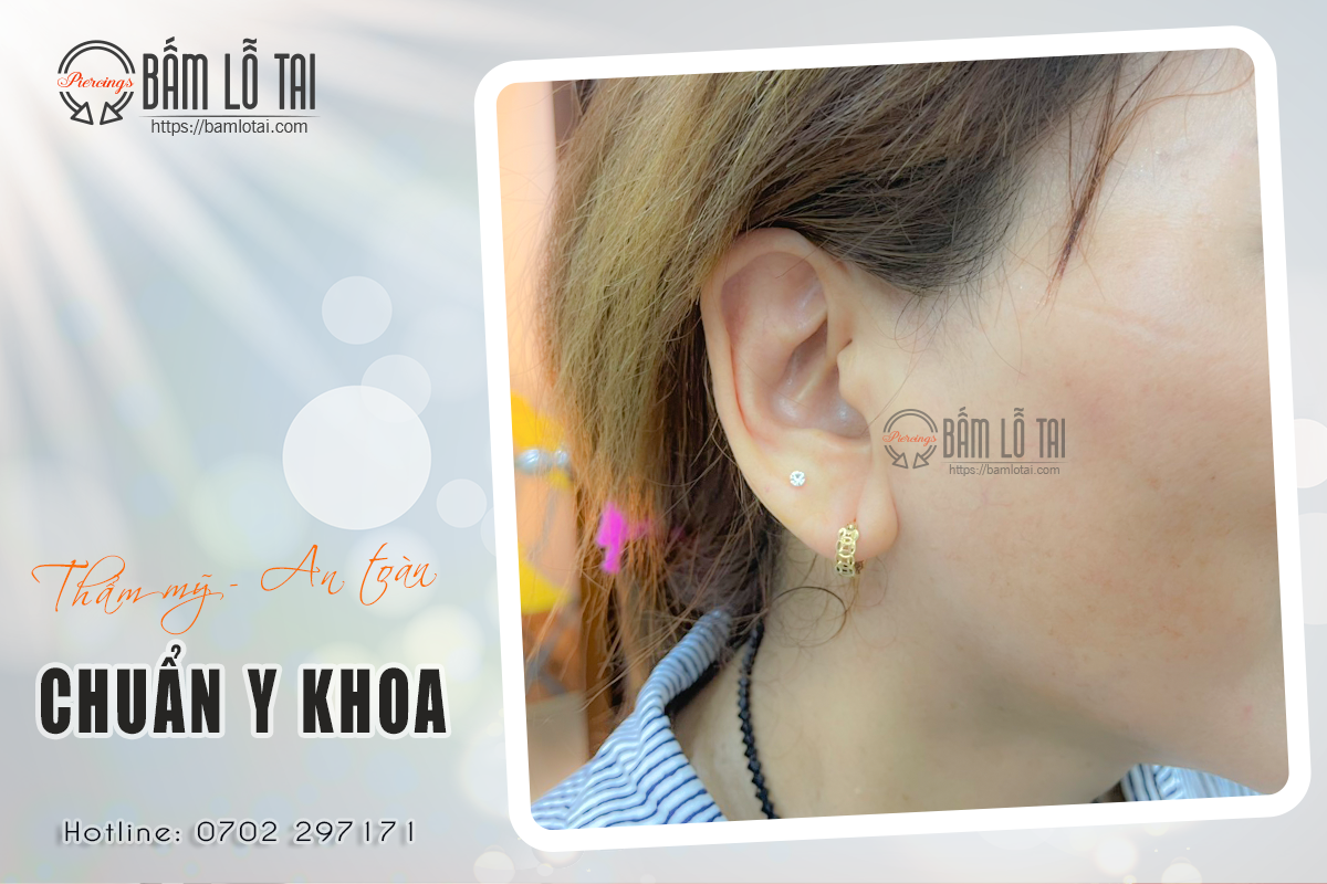 Bấm lỗ tai - Xỏ khuyên tai - Vá sẹo lỗ tai