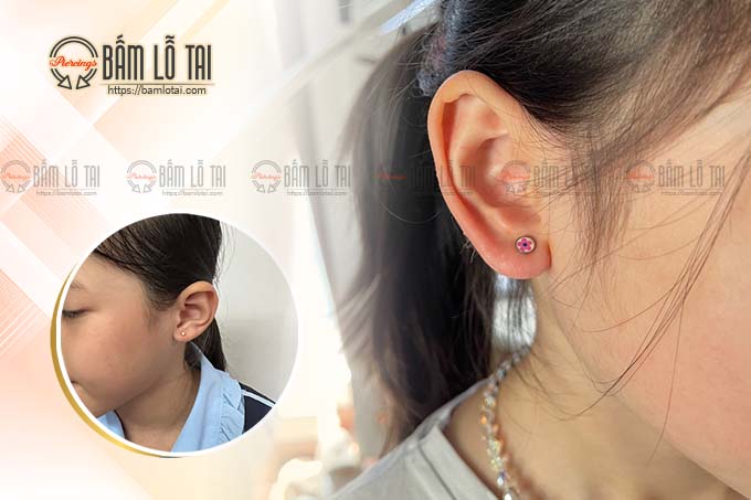 bấm lỗ tai trẻ em không đau