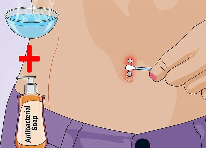 Xử lý nhiễm trùng sau xỏ khuyên