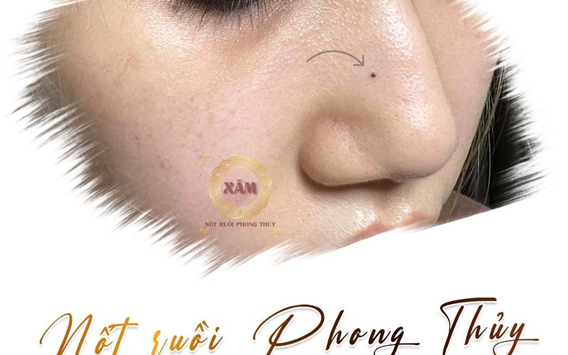 Nốt ruồi giữa sống mũi nữ có ý nghĩa phong thủy gì?