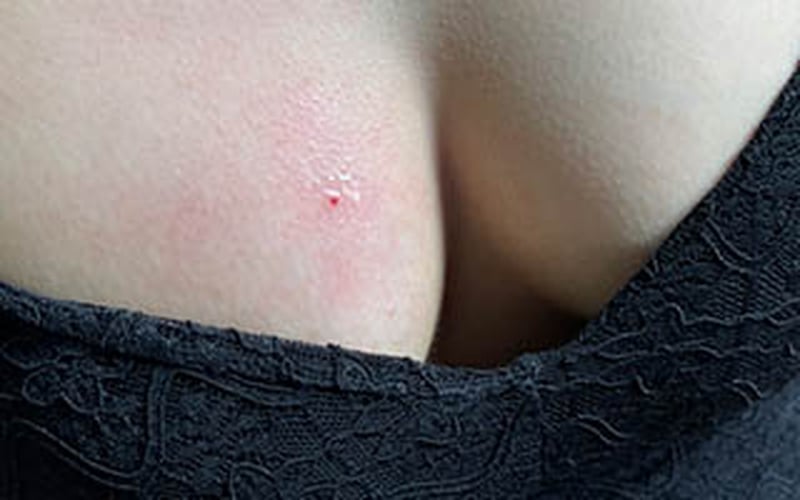 Xăm nốt ruồi son tình duyên - Vượng tình duyên, hôn nhân như ý