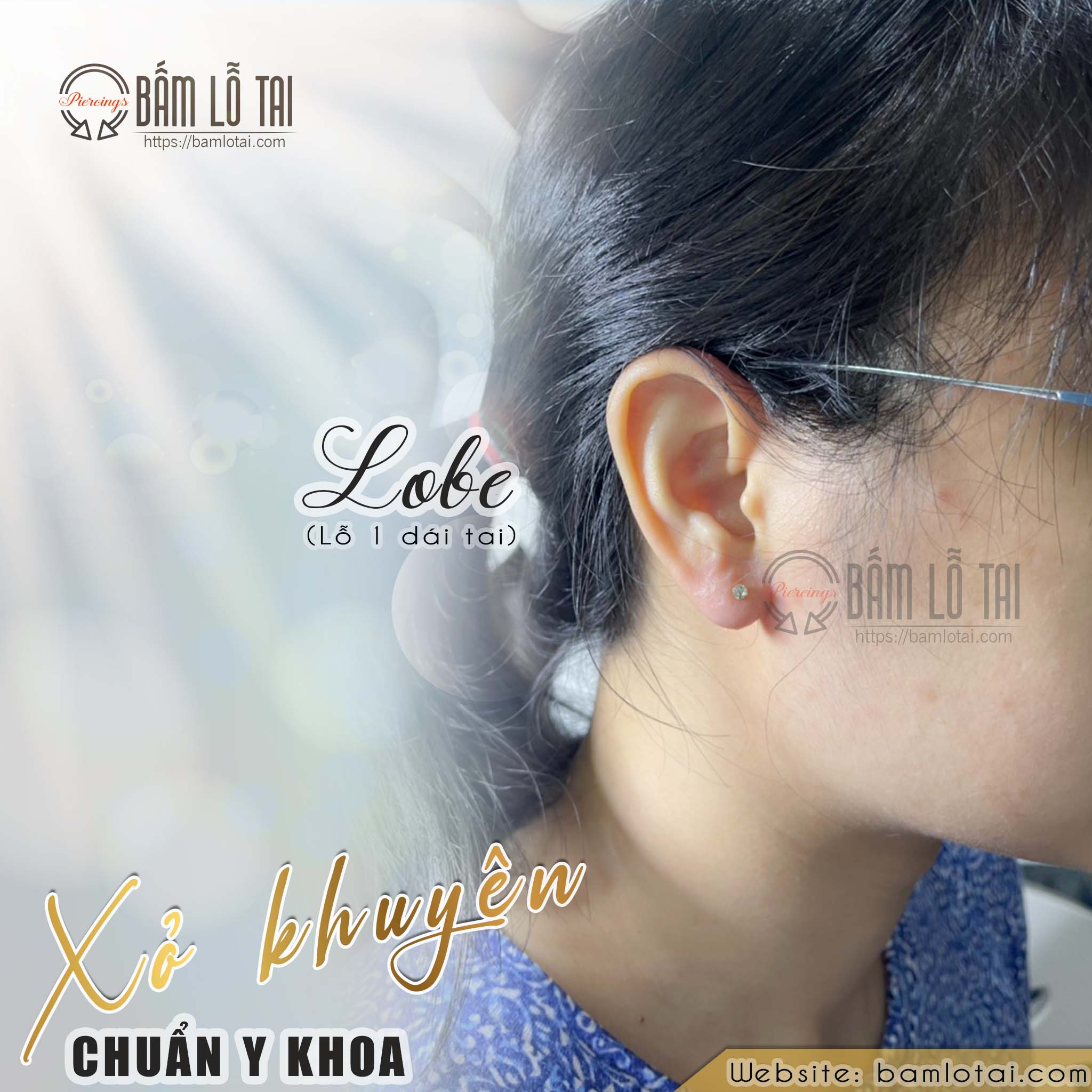 Vị trí bấm lỗ tai an toàn