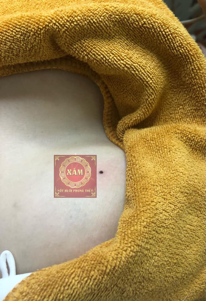 xăm nốt ruồi ngực