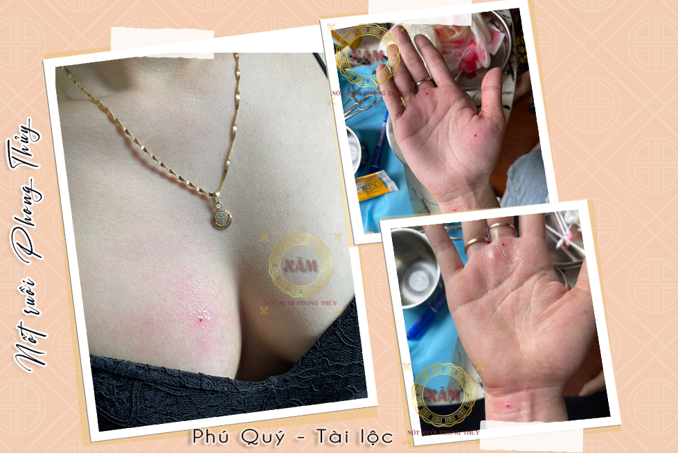 xăm nốt ruồi ngực