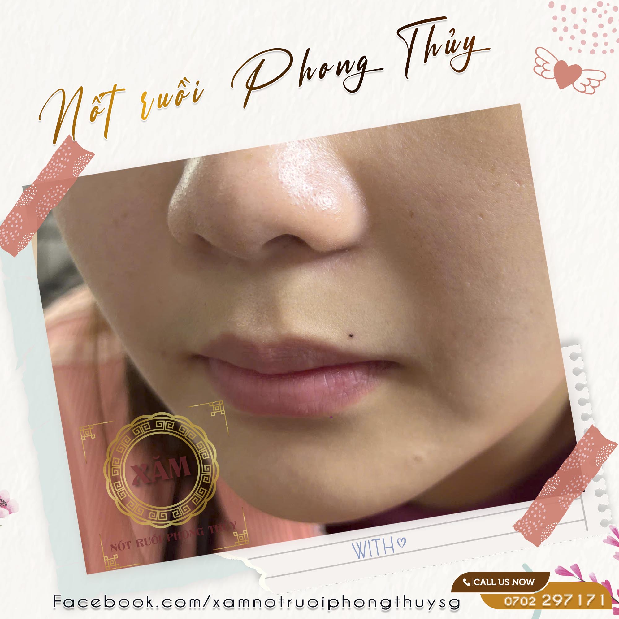 nốt ruồi trên môi nữ