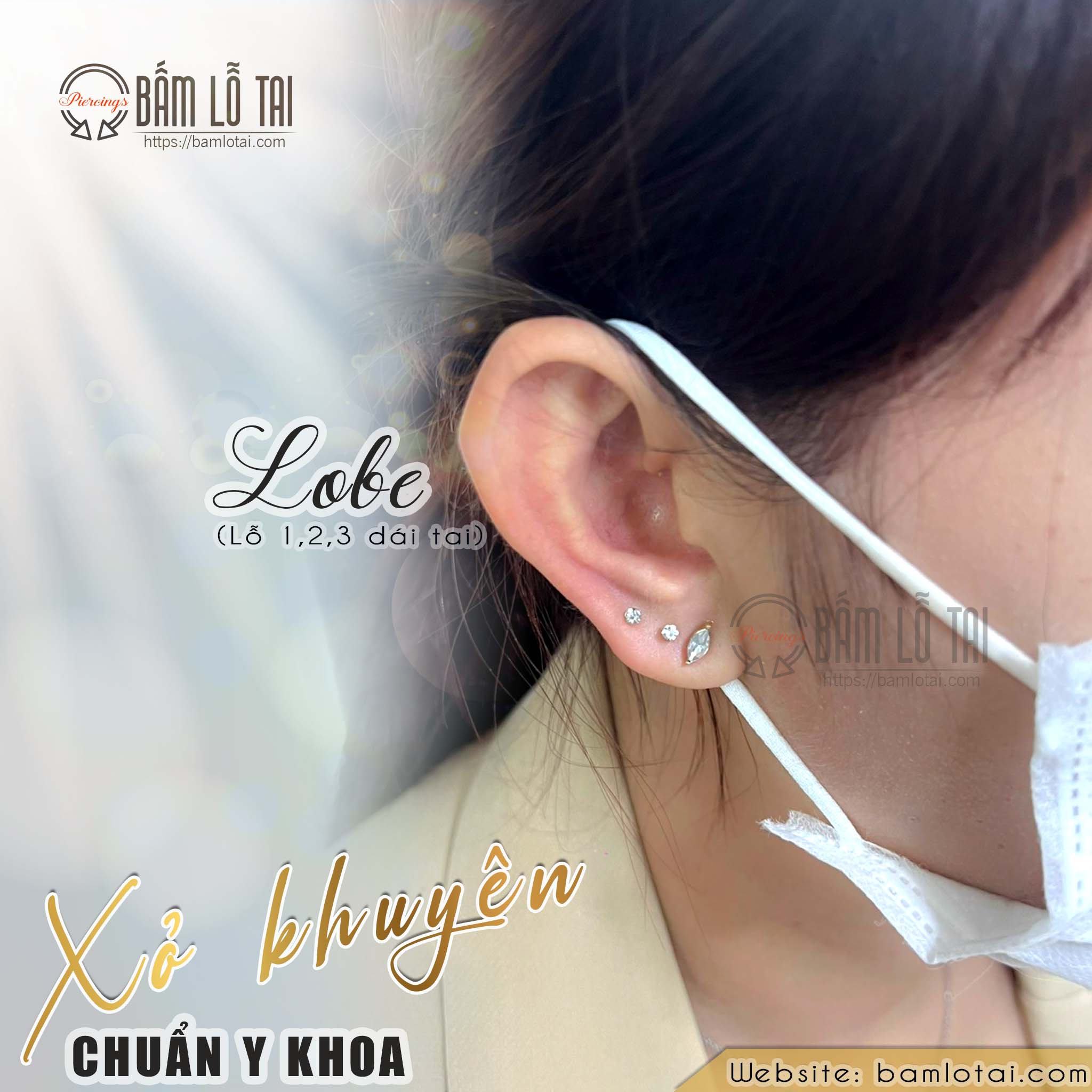 Tai biến dạng do bấm lỗ xỏ khuyên - VnExpress Sức khỏe