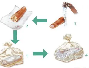 SƠ CỨU VÀ BẢO QUẢN CHI ĐỨT LÌA