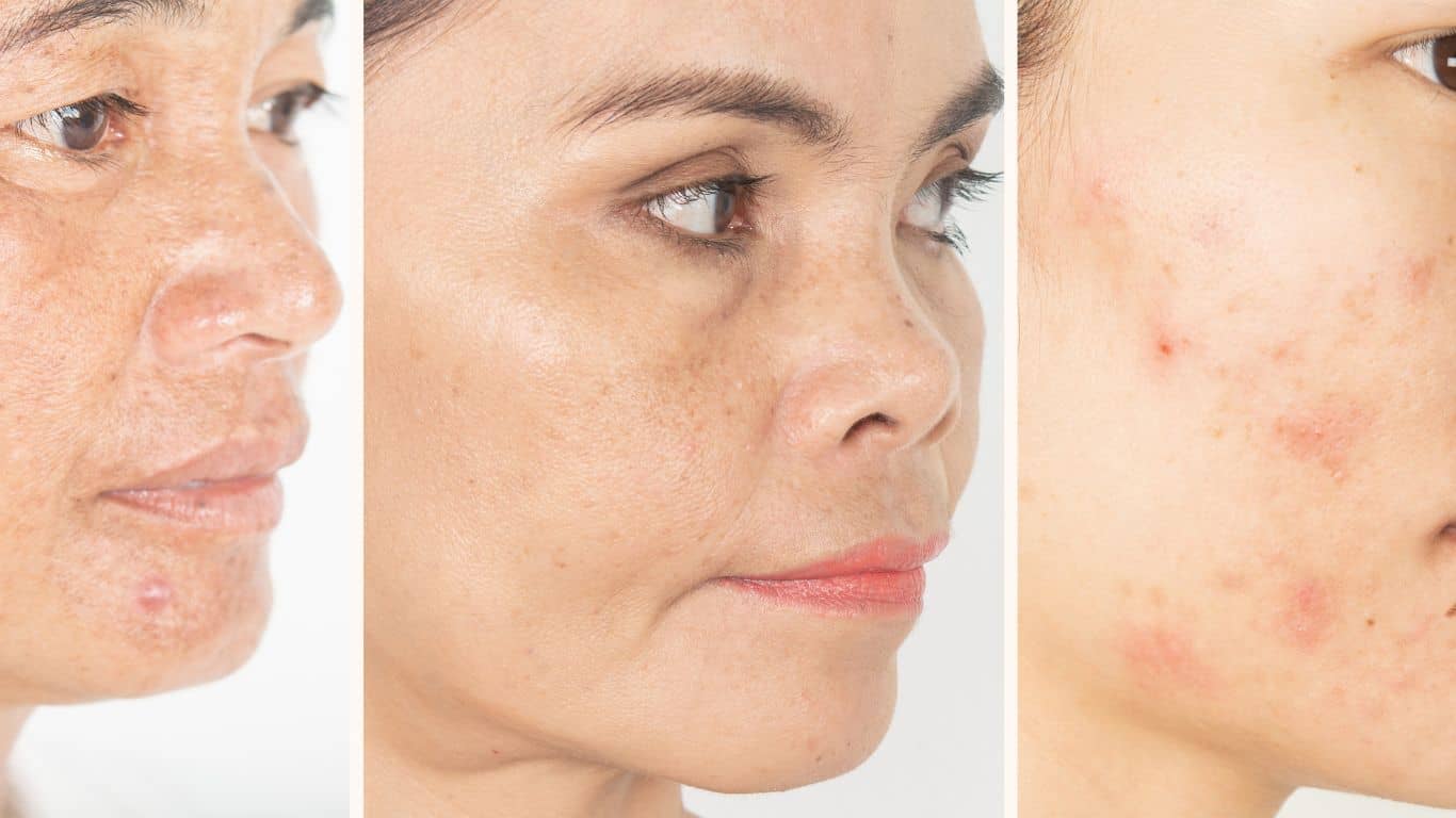 Giải mã nguyên nhân gây lão hóa da!