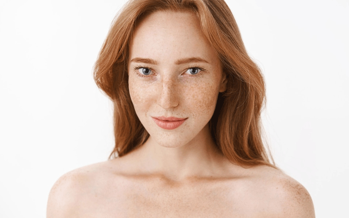 nguyên nhân gây nám tàn nhang