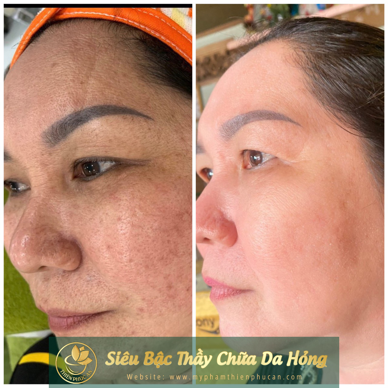 ảnh thực tế của khách hàng khi sử dụng sản phẩm Thiên Phúc An