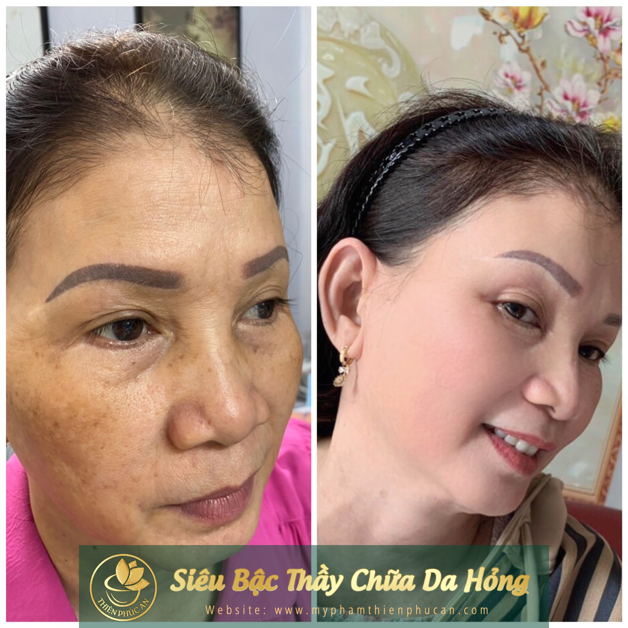 ảnh thực tế của khách hàng khi sử dụng sản phẩm Thiên Phúc An