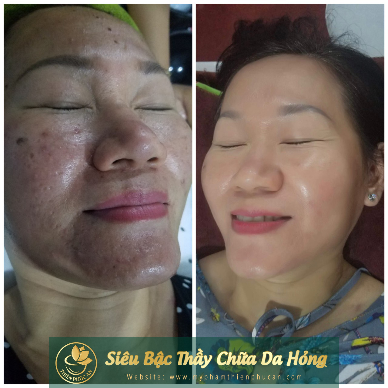 ảnh thực tế của khách hàng khi sử dụng sản phẩm Thiên Phúc An