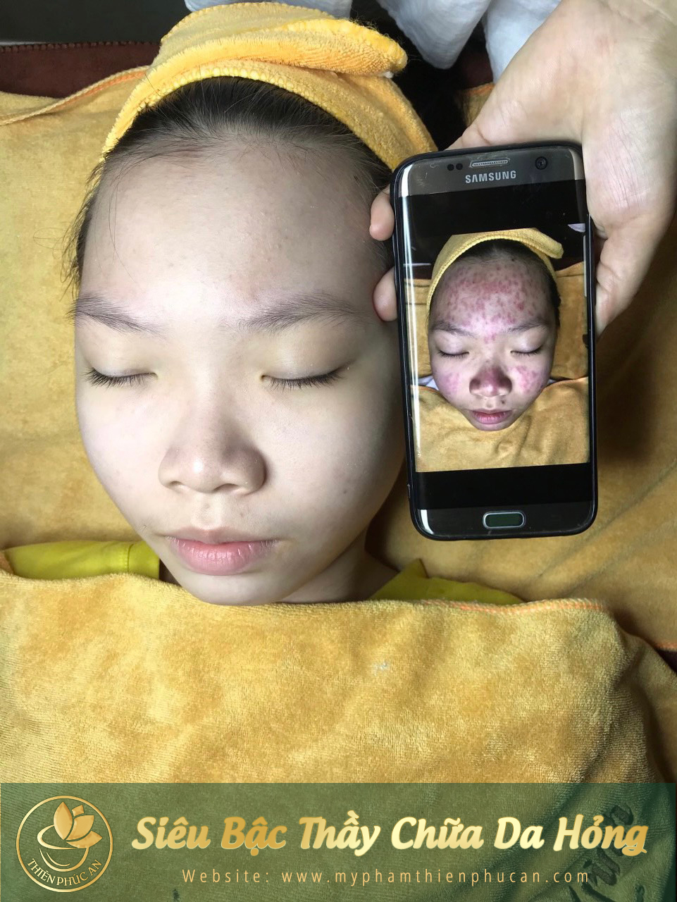 ảnh thực tế của khách hàng khi sử dụng sản phẩm Thiên Phúc An