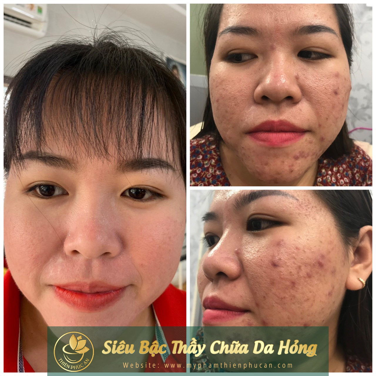 ảnh thực tế của khách hàng khi sử dụng sản phẩm Thiên Phúc An