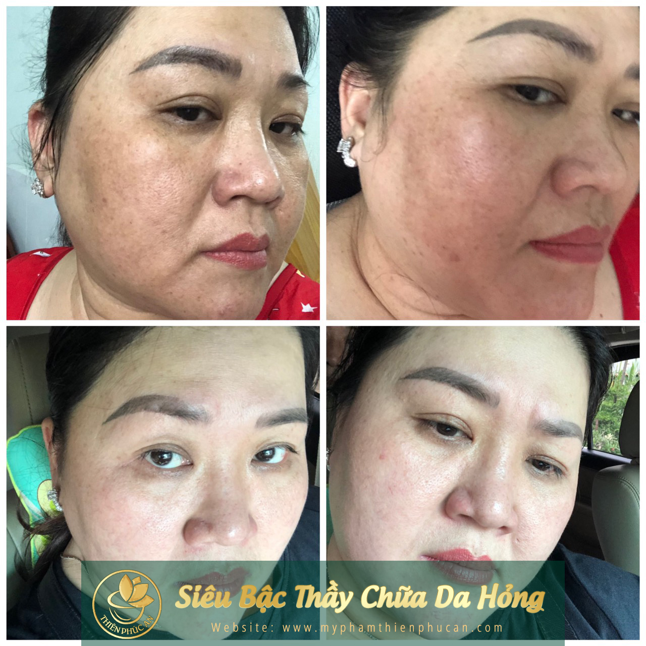 ảnh thực tế của khách hàng khi sử dụng sản phẩm Thiên Phúc An