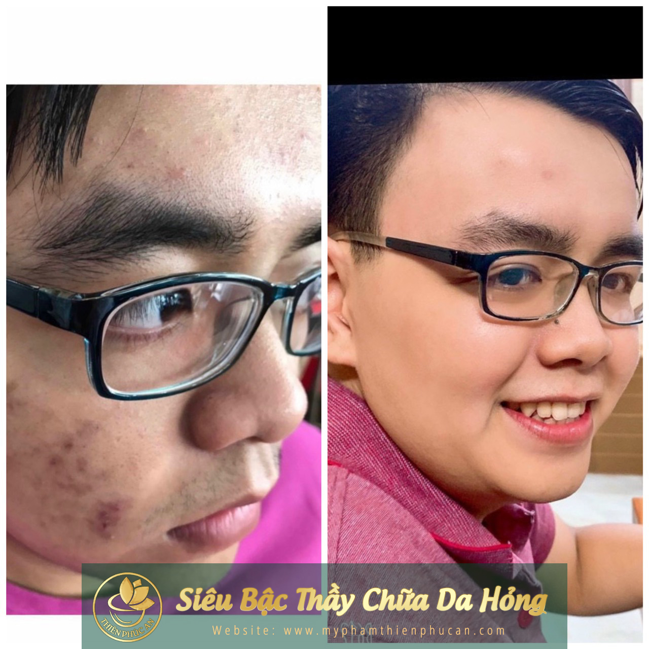 ảnh thực tế của khách hàng khi sử dụng sản phẩm Thiên Phúc An