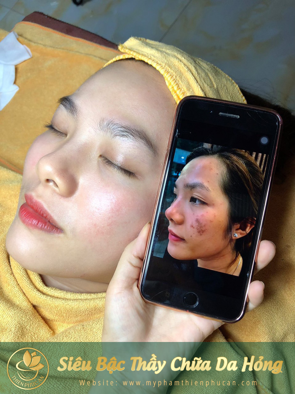 ảnh thực tế của khách hàng khi sử dụng sản phẩm Thiên Phúc An