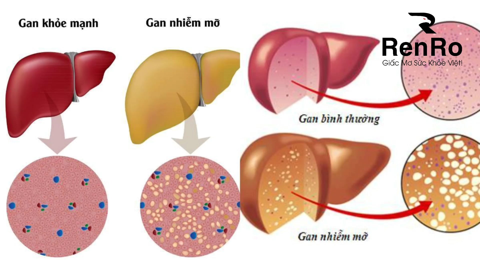 Giải độc gan đông trùng hạ thảo Giải độc gan đông trùng hạ thảo