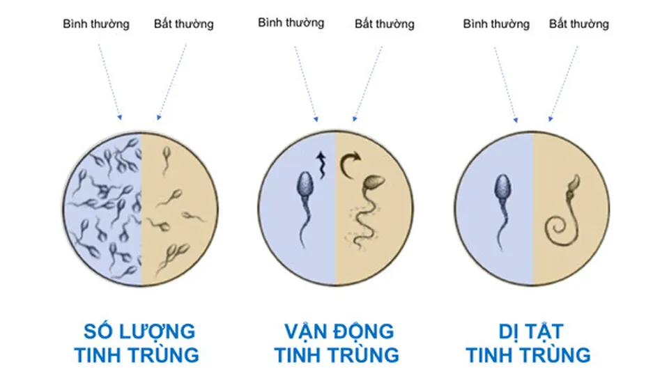 Nam giới có 6 đặc điểm này chứng tỏ khả năng sinh sản tốt