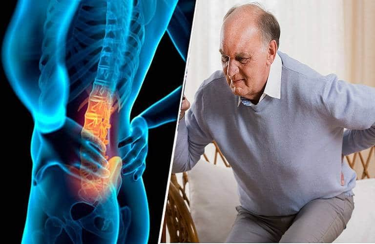 Đau lưng ở người cao tuổi - Nguyên nhân và phương pháp chữa trị - Doctogo.vn